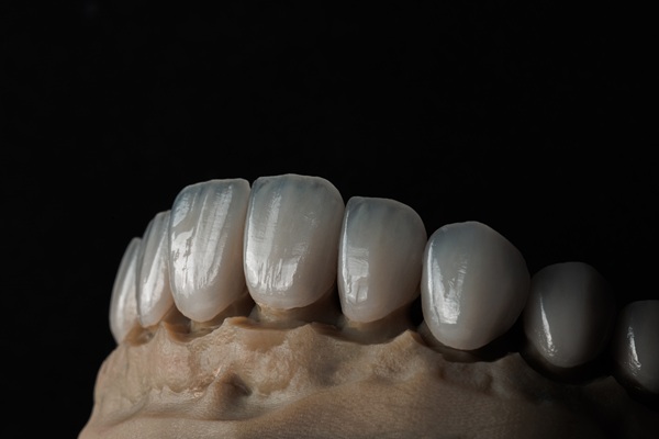 How Easy Is It To Replace An Implant Crown?